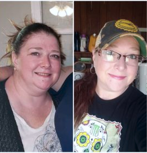 before and after medically assisted weight loss