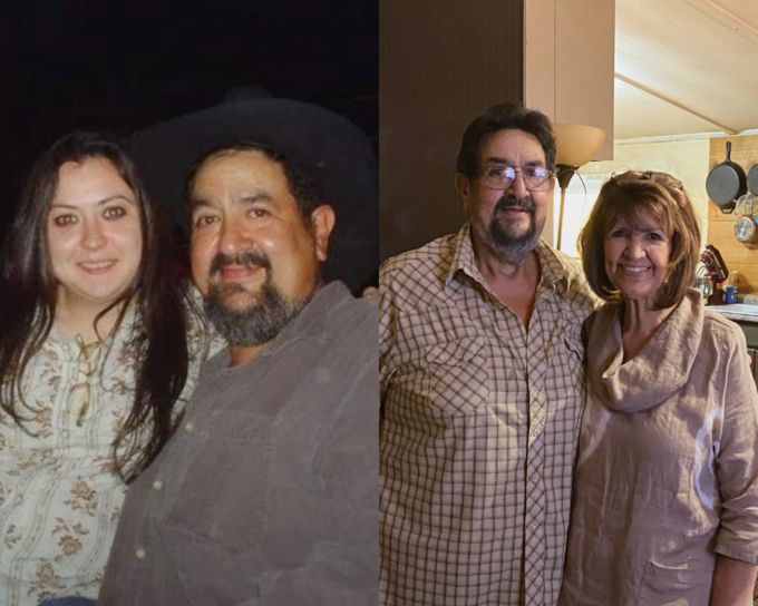 before and after medically assisted weight loss